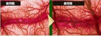 1740652225452477.jpg bb1a7d280485af06a3b41f1af4a106b.jpg